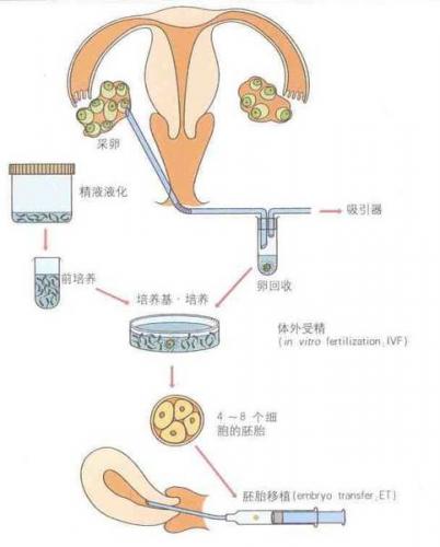 第三代赠卵试管婴儿要取多少个卵子才算成功？