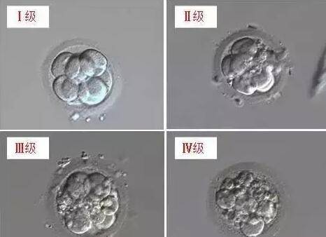 供卵生子代怀试管的预期寿命真的比自然受孕的婴儿短吗？