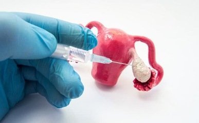 广州找卵子医院，为客户制定一站式解决方案--第一做借卵试管网