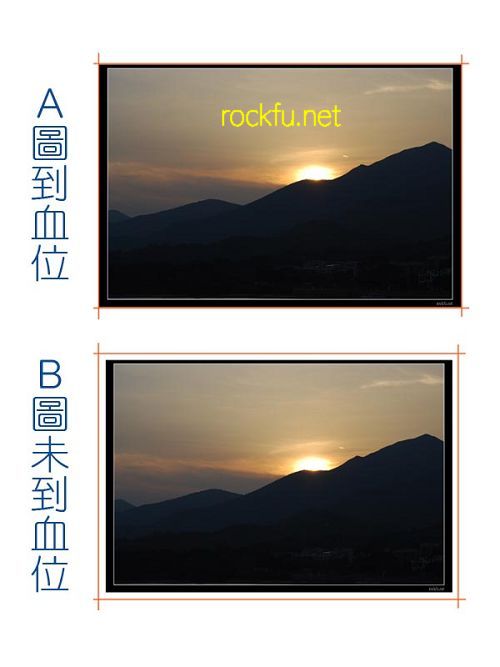 供卵做公立供卵试管染色体异常生出缺陷儿的概率高