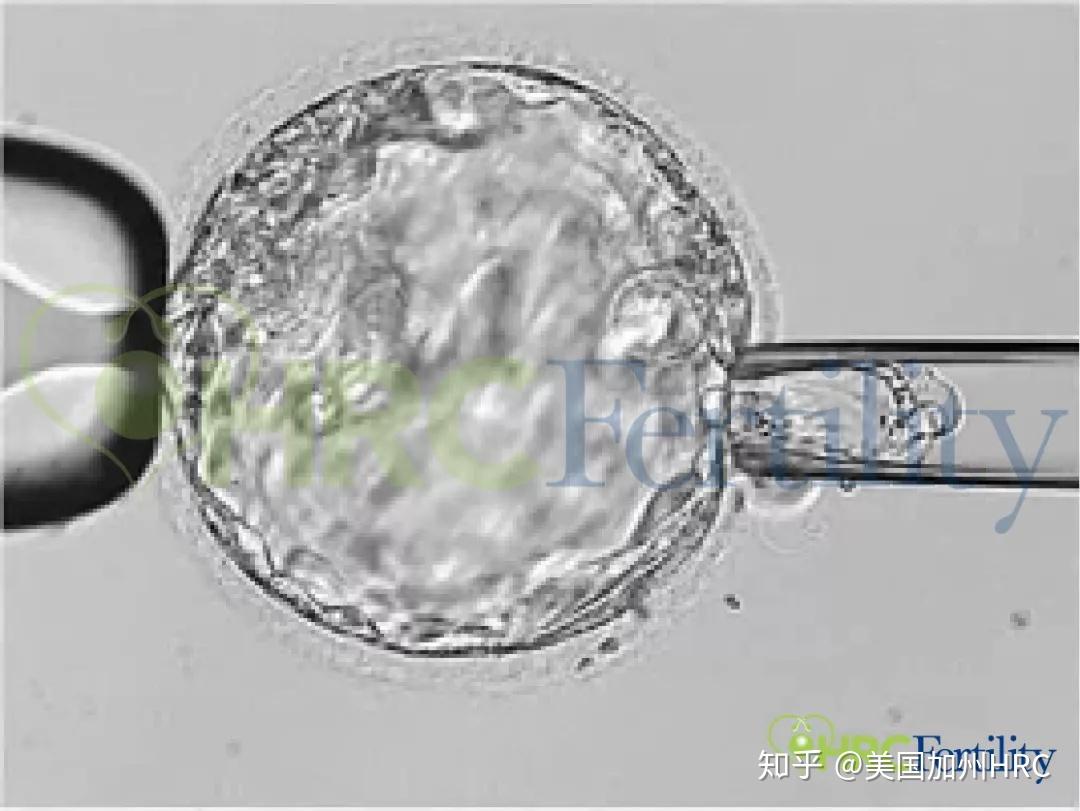 辽宁市妇幼保健院供卵试管成功率