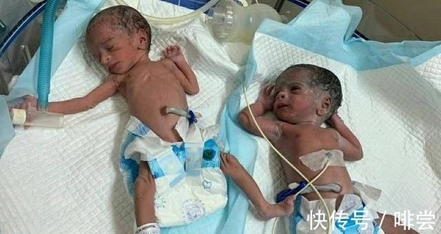 沈阳省妇幼保健院三代借卵试管婴儿