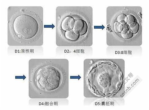 威廉和本特利为什么是做供卵试管
