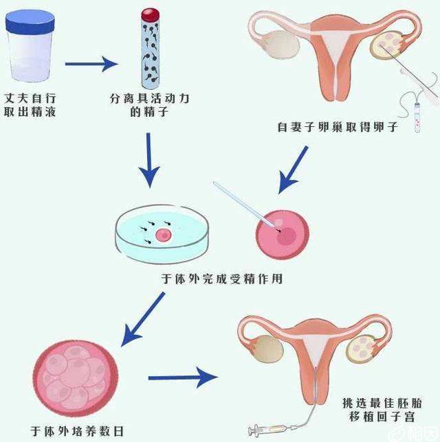 辽宁沈阳试管成功率高的医院排名
