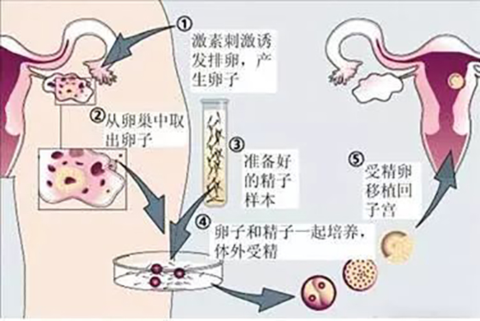 经验分享试管打丽申宝促排需要几天