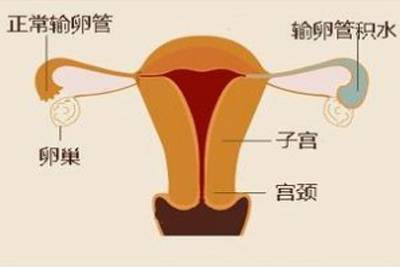 沈阳仁济医院亲戚试管代怀产子怎么样
