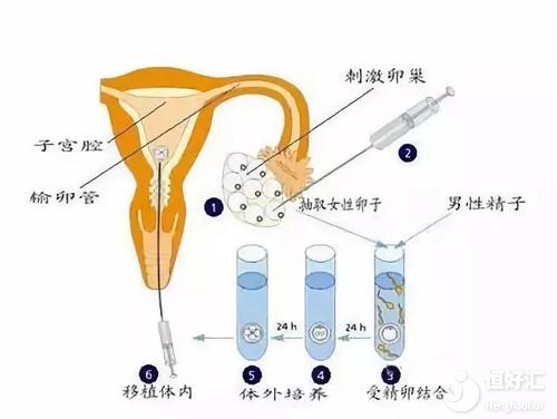 沈阳试管代怀的方法多少钱（也许73196元）