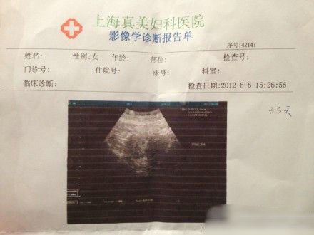 结扎后能供精试管服务婴儿吗优生失独机构的条件你需要了解