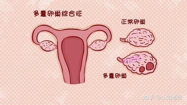 沈阳人工授精要多少钱（会让身体越来越差吗）